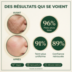 Kinetica Clarté — Soin Anti-Cicatrices & Marques d'Acné | Silicone Médical